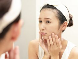 Ini 4 Cara Atasi Flek Hitam Wajah di Usia Muda