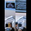RS TK III dr. Bratanata Jambi Kini Punya Alat Canggih CBCT, Pemeriksaan Gigi Lebih Akurat dan Modern