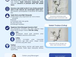Siloam Jambi Berhasil Deteksi dan Tangani Aneurisma Otak Tanpa Bedah Terbuka